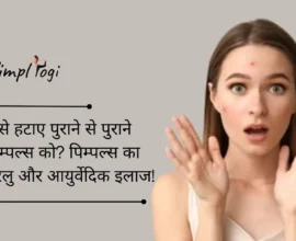 कैसे हटाए पुराने से पुराने पिम्पल्स को? पिम्पल्स का घरेलु और आयुर्वेदिक इलाज!