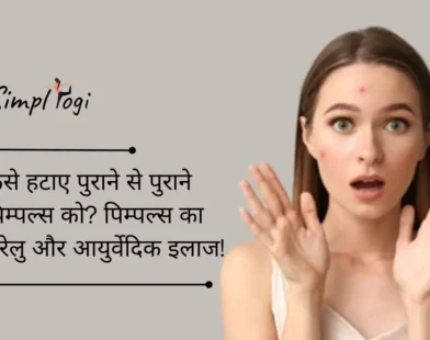 कैसे हटाए पुराने से पुराने पिम्पल्स को? पिम्पल्स का घरेलु और आयुर्वेदिक इलाज!
