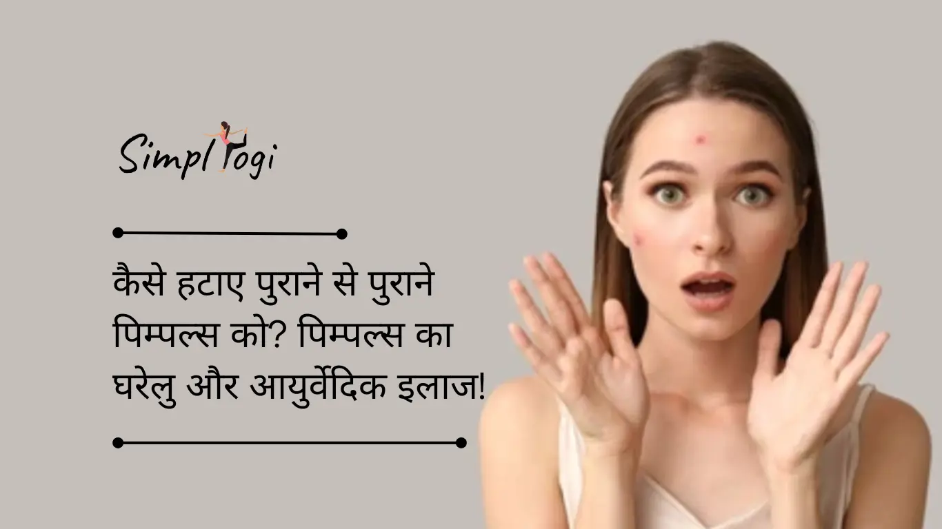 कैसे हटाए पुराने से पुराने पिम्पल्स को? पिम्पल्स का घरेलु और आयुर्वेदिक इलाज!